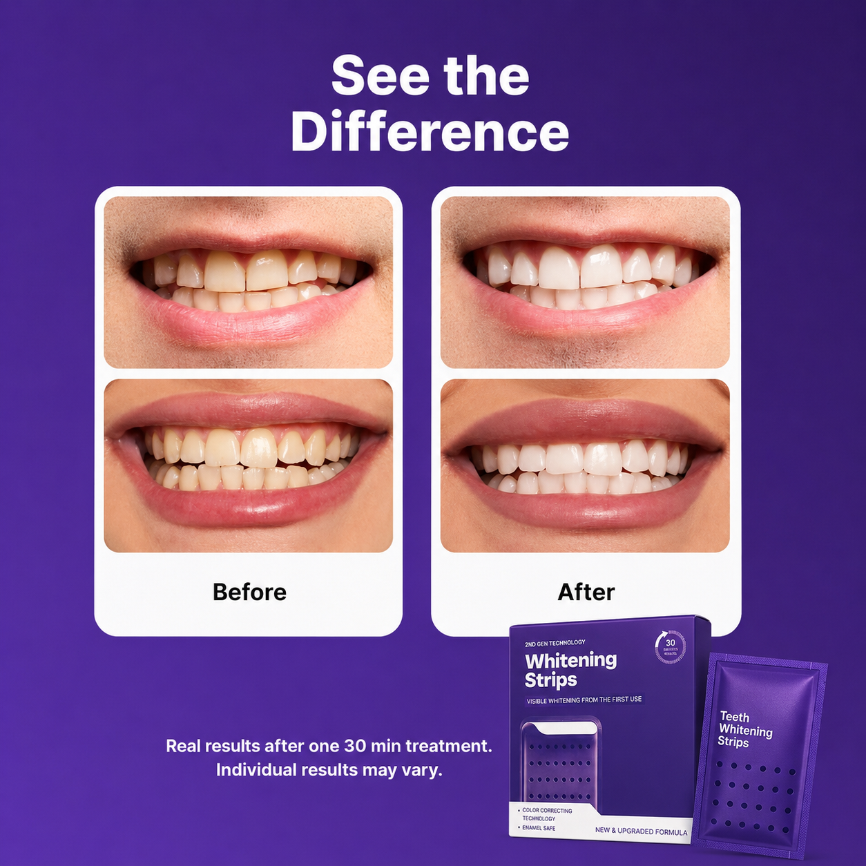 💜✨Peroxide-Free Purple Teeth Whitening Strips 💜✨